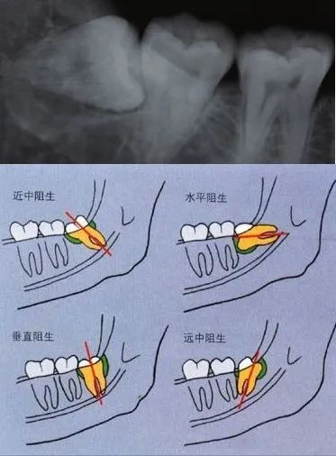 案例图片