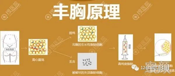 https://img.yiyiaimei.com/mnt/timg/200303/140G94501-2.jpg