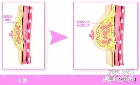 https://img.yiyiaimei.com/mnt/timg/200303/140GJE2-0.jpg
