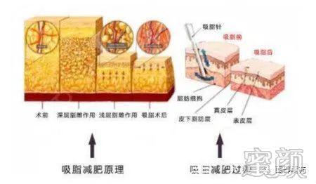 案例图片