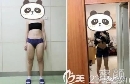 案例图片