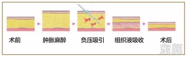 案例图片