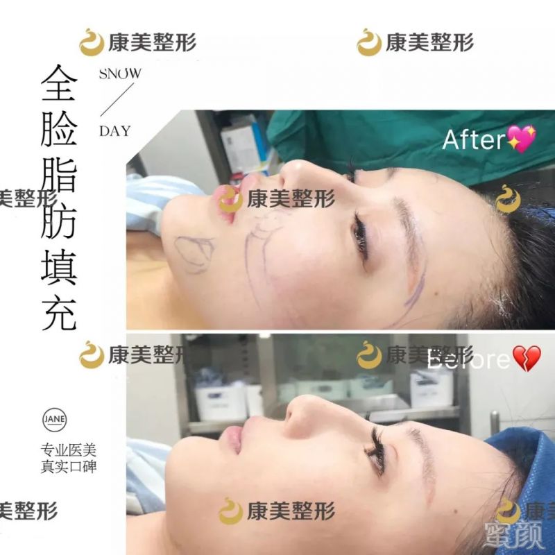 https://img.yiyiaimei.com/mnt/timg/200303/141JW1S-2.jpg