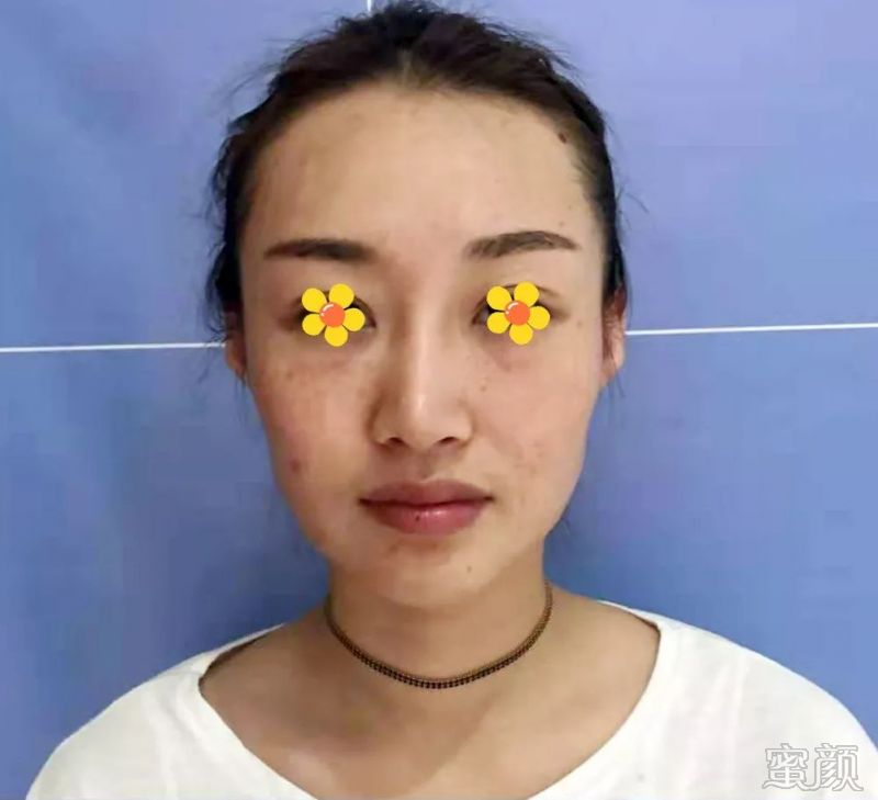 案例图片
