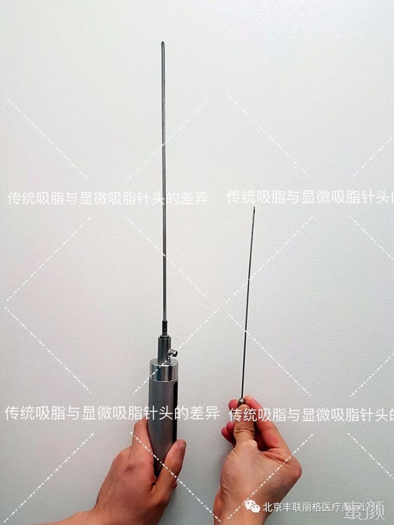 https://img.yiyiaimei.com/mnt/timg/200304/1414515012-0.jpg 案例图片
