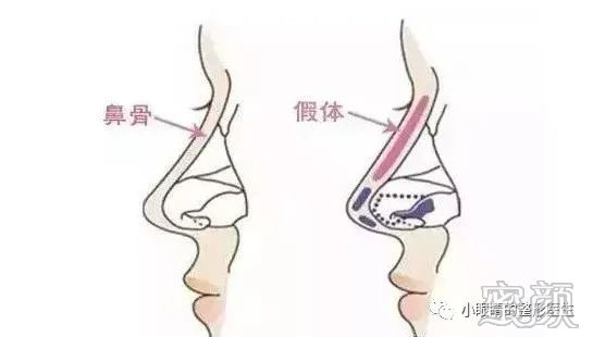 案例图片