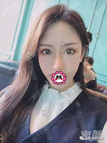 案例图片