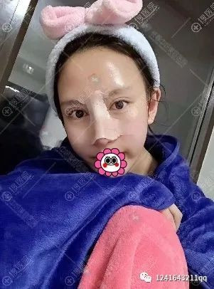案例图片