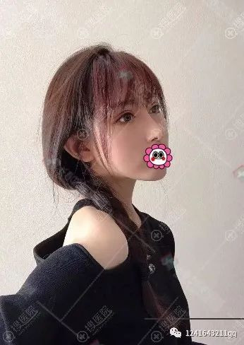 案例图片