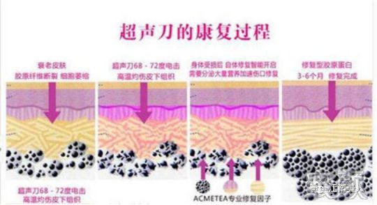 案例图片
