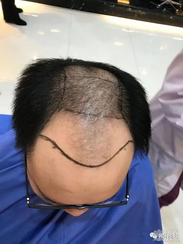 https://img.yiyiaimei.com/mnt/timg/200304/14423111B-2.jpg