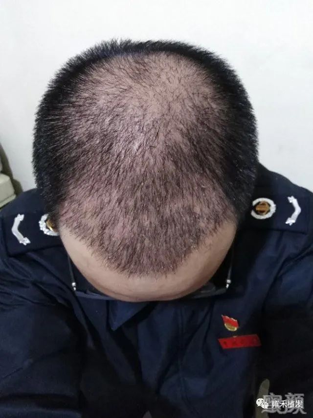 https://img.yiyiaimei.com/mnt/timg/200304/1442333208-6.jpg