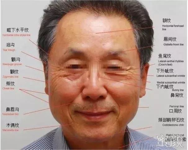 https://img.yiyiaimei.com/mnt/timg/200305/143S46305-1.jpg