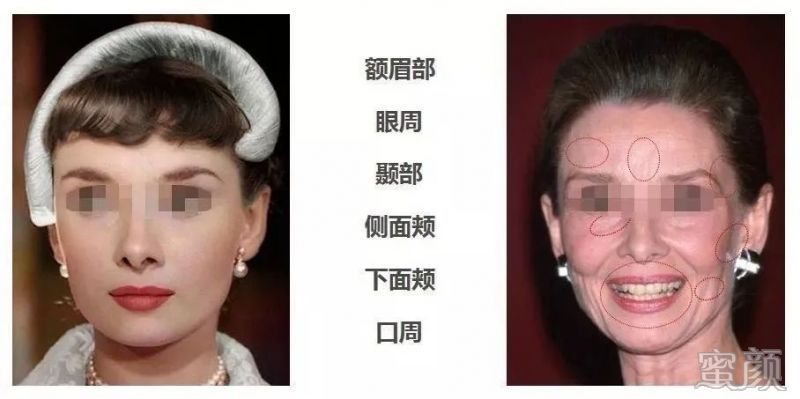 https://img.yiyiaimei.com/mnt/timg/200305/143S53320-3.jpg