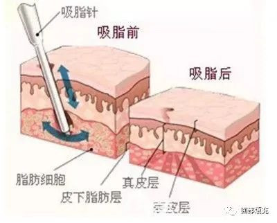https://img.yiyiaimei.com/mnt/timg/200305/14413G1E-1.jpg