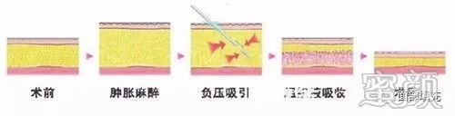 案例图片