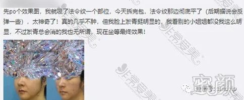 https://img.yiyiaimei.com/mnt/timg/200305/15050929D-4.jpg