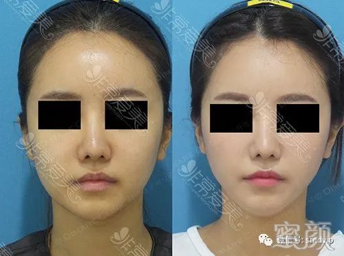 https://img.yiyiaimei.com/mnt/timg/200305/1505093124-3.jpg