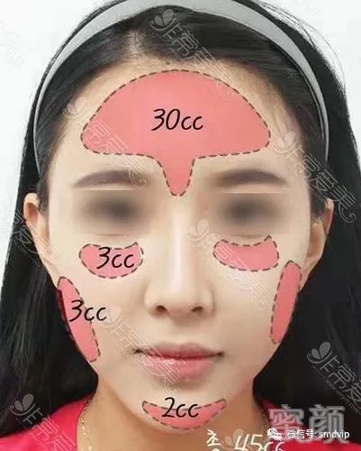 https://img.yiyiaimei.com/mnt/timg/200305/15050U013-2.jpg