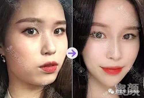 https://img.yiyiaimei.com/mnt/timg/200305/1505102360-6.jpg