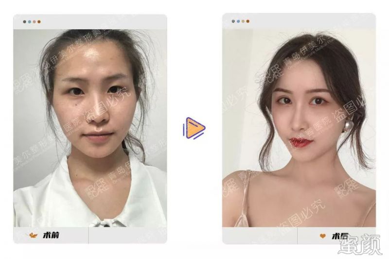 https://img.yiyiaimei.com/mnt/timg/200305/1530145302-1.jpg