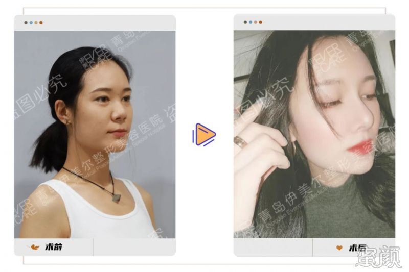 https://img.yiyiaimei.com/mnt/timg/200305/1530163912-2.jpg
