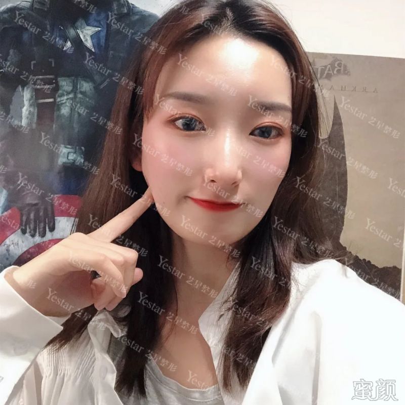 https://img.yiyiaimei.com/mnt/timg/200305/153JV623-7.jpg 案例图片