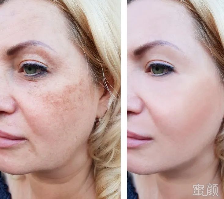 https://img.yiyiaimei.com/mnt/timg/200305/1630105611-9.jpg