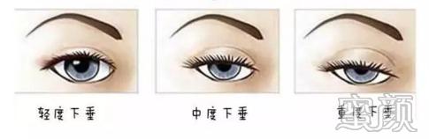 案例图片