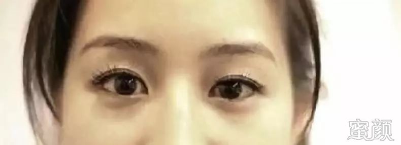 案例图片