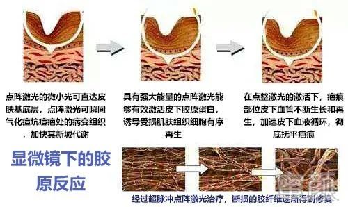 案例图片