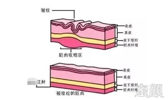 案例图片