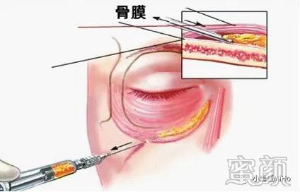 案例图片