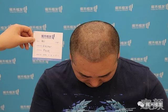 https://img.yiyiaimei.com/mnt/timg/200306/1540552142-9.jpg