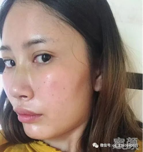 案例图片
