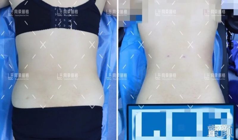 https://img.yiyiaimei.com/mnt/timg/200307/1345192235-7.jpg