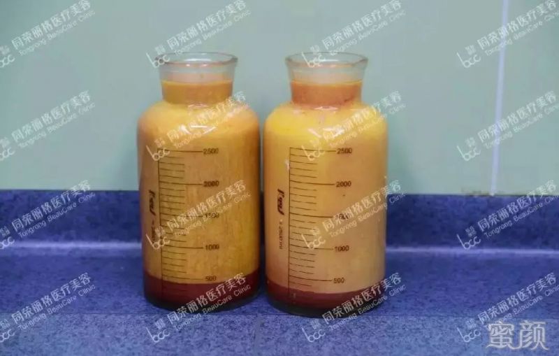 https://img.yiyiaimei.com/mnt/timg/200307/13451I952-4.jpg