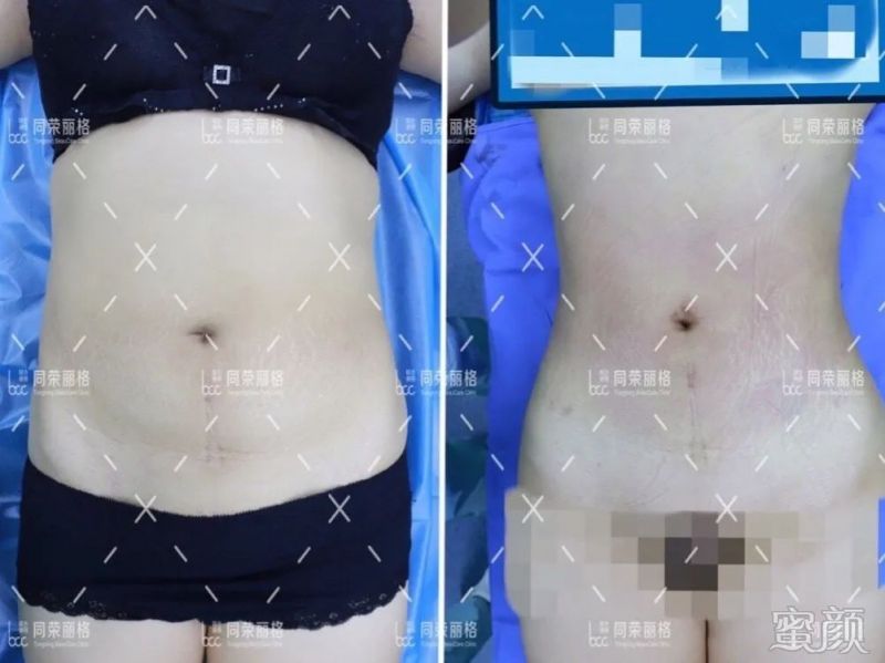 https://img.yiyiaimei.com/mnt/timg/200307/13451WE5-6.jpg