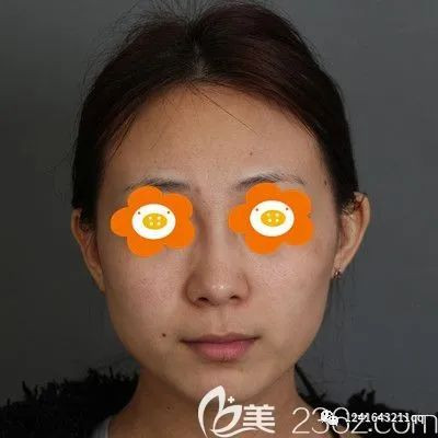 案例图片