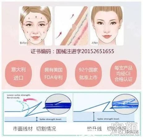 案例图片