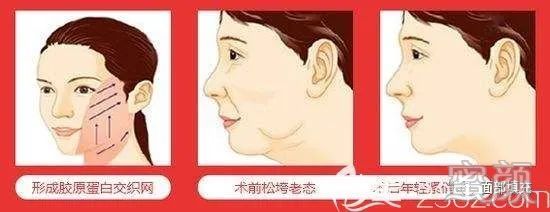 案例图片