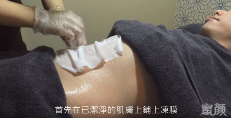 https://img.yiyiaimei.com/mnt/timg/200307/1413551F8-4.jpg 案例图片