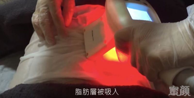 https://img.yiyiaimei.com/mnt/timg/200307/1413561C1-5.jpg 案例图片