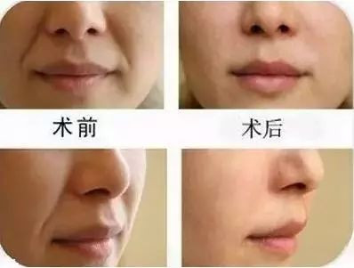 https://img.yiyiaimei.com/mnt/timg/200307/14135I463-7.jpg 案例图片
