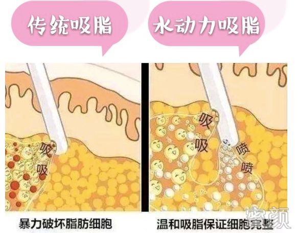 https://img.yiyiaimei.com/mnt/timg/200307/1414045402-12.jpg 案例图片