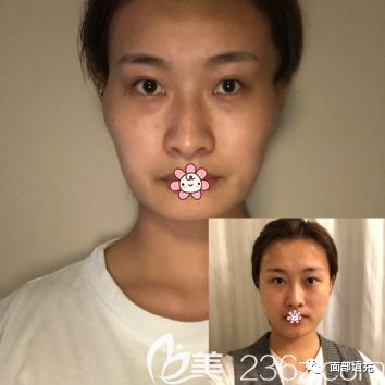 https://img.yiyiaimei.com/mnt/timg/200307/142K21E5-5.jpg
