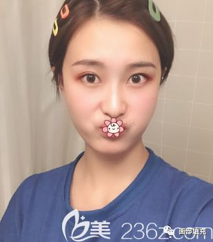 https://img.yiyiaimei.com/mnt/timg/200307/142K21Q9-4.jpg