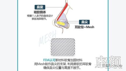 案例图片