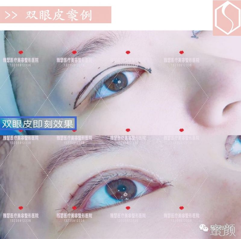 https://img.yiyiaimei.com/mnt/timg/200308/134Z4F06-2.jpg
