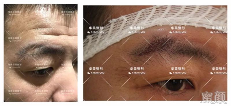 https://img.yiyiaimei.com/mnt/timg/200308/14225W412-2.jpg